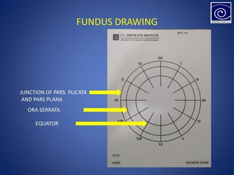 Indirect ophthalmoscopy and fundus drawing | PPT