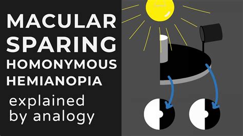 Macular Sparing & Splitting Homonymous Hemianopia | Animation | Explained Conceptually - YouTube