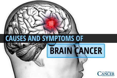 Causes and Symptoms of Brain Cancer