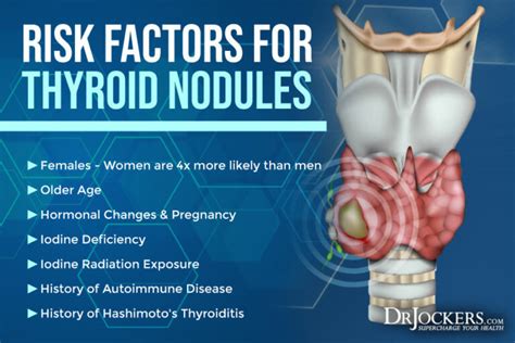 Thyroid Nodules: Symptoms, Causes, and Support Strategies