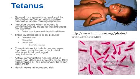 Clostridium Tetani Symptoms