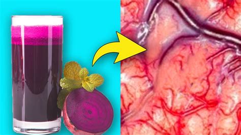 Shocking Side Effects of Drinking Beetroot Juice in Excess - Side Effects of Beets - YouTube