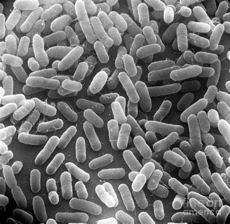 Escherichia coli – scheda batteriologica ed approfondimenti