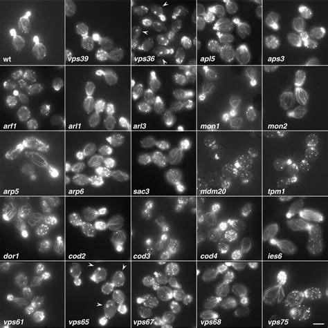 Visualization of the actin cytoskeleton in wild-type and mutant strains ...