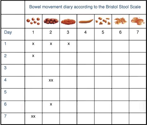 Image result for bristol stool chart pdf | Bristol stool chart, Bristol stool, Stool chart