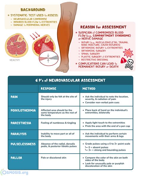 Neurovascular Assessment: What Is It, Why It’s Performed, and More | Osmosis