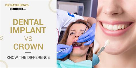 Dental Implant vs Crown – Know the Difference