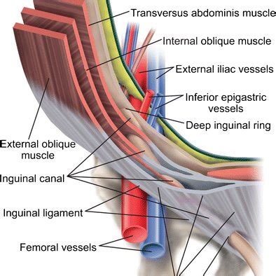 Diagram of right inguinal canal anatomy depicts the main elements that ...