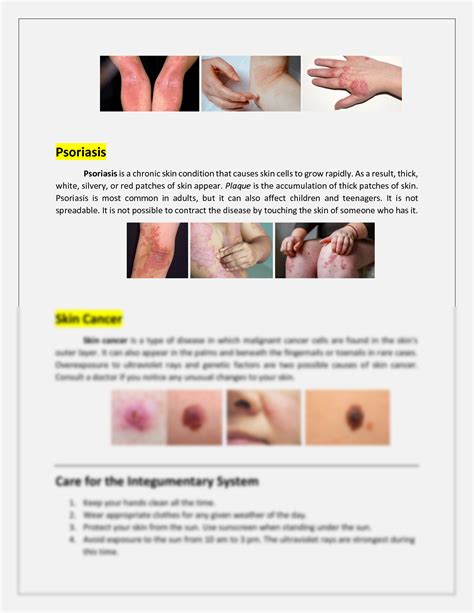 SOLUTION: Diseases of the integumentary system - Studypool