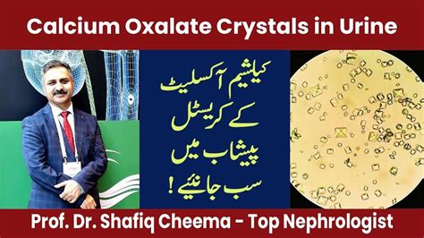 Calcium Oxalate Crystals in Urine | Causes , Symptoms & Treatment #oxalate #calcium #kidneystone ...