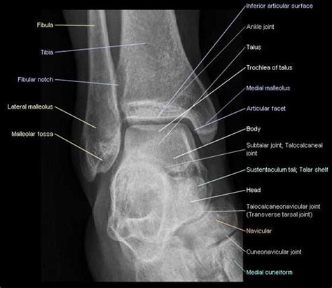 Arteries and bones of the lower extremity: Interactive atlas of human ...