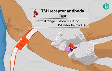 TSH receptor antibody test: Procedure, Purpose, Results, Normal range ...