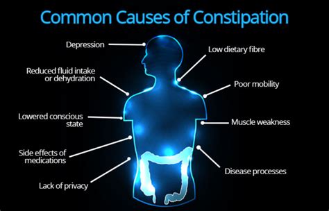 Top Home Remedies for Constipation | Remedies for Constipation Relief