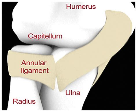 Reduction of Pulled Elbow | NEJM