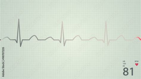 Animation of a schematic diagram of normal sinus rhythm for a human heart Stock Video | Adobe Stock