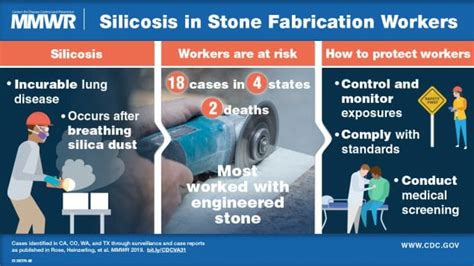 Silica Exposure Causes Silicosis - Washington Workers' Advisor