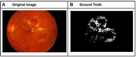 Frontiers | Simultaneous segmentation of multiple structures in fundal images using multi ...