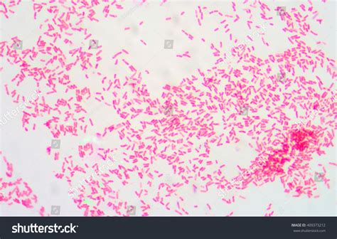 938 Gram Negative Bacilli Images, Stock Photos & Vectors | Shutterstock