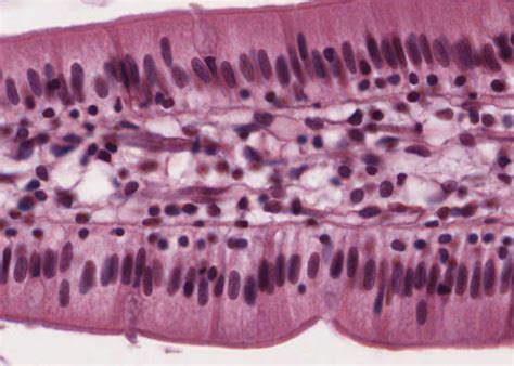 Epithelium – Meyers Histology