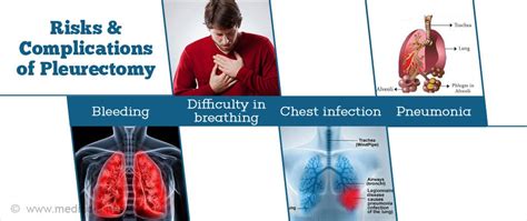 Pleurectomy - Types, Risks & Complications