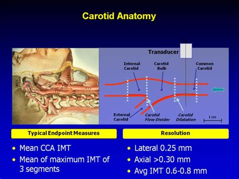 ascending pharyngeal artery on ultrasound color doppler - Google Search | Ultrasound, Vascular ...