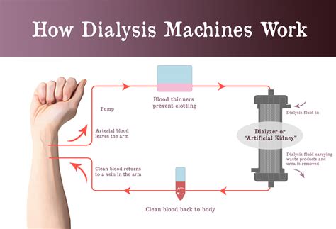 Dialysis Machine Circuit Diagram