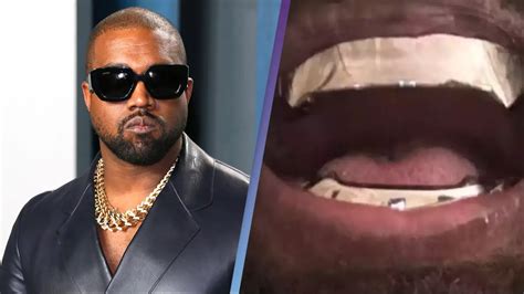 Kanye West's titanium teeth leave people wondering how he'll clean them - News - UNILAD