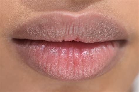 7 Gründe, weswegen Du spröde Lippen haben könntest - Hogmag