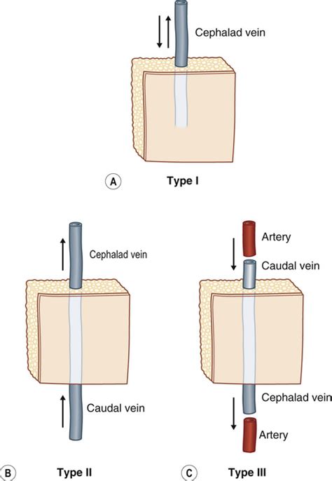 Flaps and Microsurgery | Plastic Surgery Key