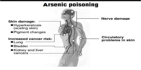 Arsenic Poisoning - Overview - Assignment Point