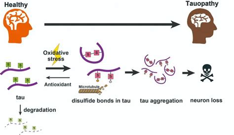 Toxicity of Protein Involved in Alzheimer's Triggered by Chemical "Switch"