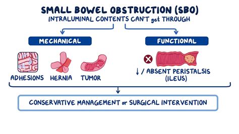 Small bowel obstruction: Clinical sciences - Osmosis Video Library