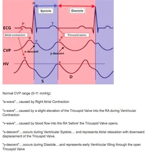 1000+ images about Haemodynamic Monitoring on Pinterest | Definitions ...