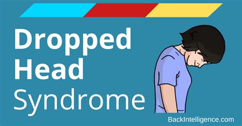 Dropped Head Syndrome Causes & Treatment Options