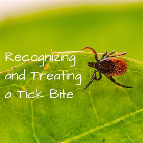 Tick Bite: Pictures, Symptoms, Causes, Treatment - YouMeMindBody