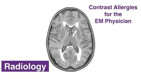 Contrast Allergies for the Emergency Medicine Physician — NUEM Blog