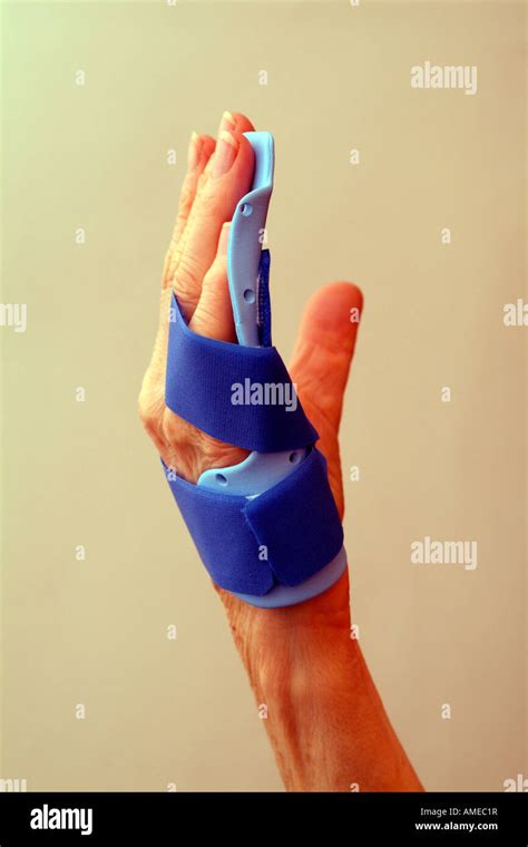 Hand Splint For Dupuytren's Contracture Online Stores | www ...