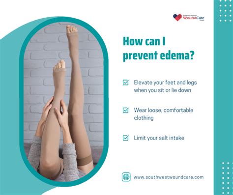 Edema Causes, Symptoms and Treatment in Lubbock, TX