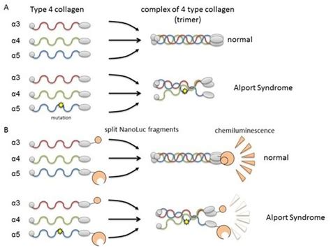 Alport syndrome severity can be predicted by causative protein genotype