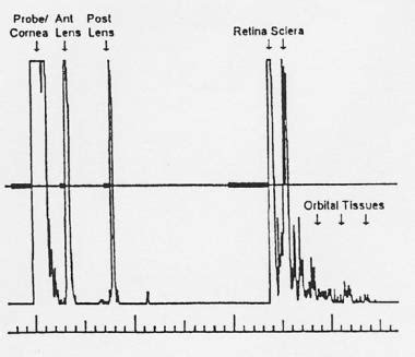 amplitude - Unit of ultrasound A-scans - Electrical Engineering Stack Exchange