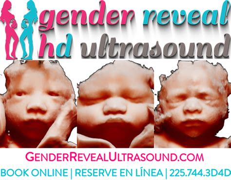 Book an Ultrasound | Prairieville, La | Gender Reveal HD Ultrasound