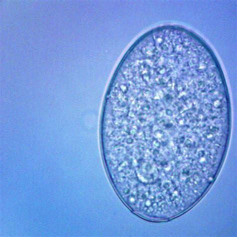 Fasciolopsis buski Eggs, w.m. Microscope Slide | Carolina Biological Supply