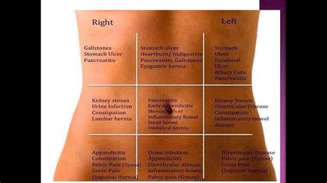 GI Assessment 2 - YouTube