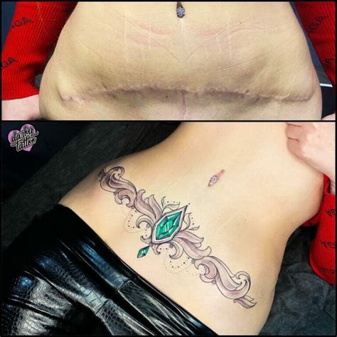 10 Best Hysterectomy Scar Tattoo Ideas That Will Blow Your Mind!