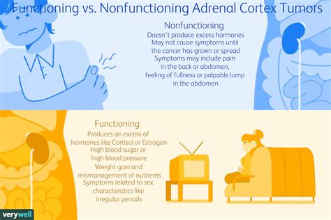 Adrenocortical Carcinoma: Signs, Symptoms, Complications