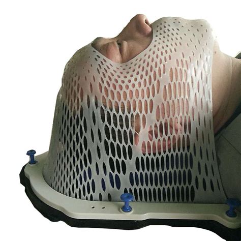 Reinforced radiotherapy mask with eyes nose open for brain tumor therapy | Brain tumor, Brain ...