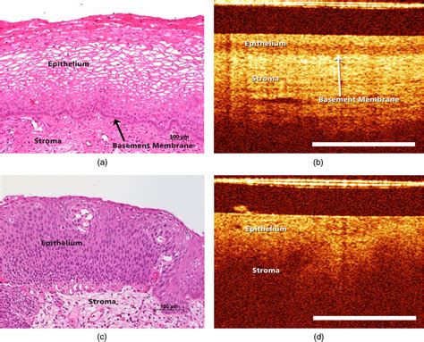 (a) Histological image of normal cervical squamous epithelium. The ...