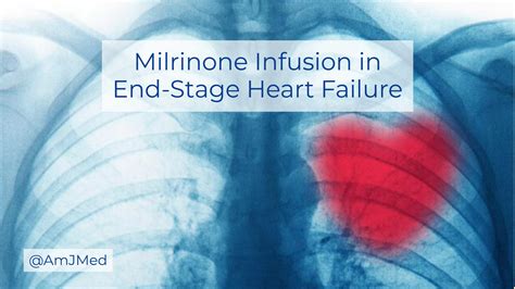 Safety of Outpatient Milrinone Infusion in End-Stage Heart Failure ...