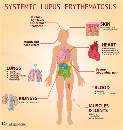 Pin on Fighting Inflammation