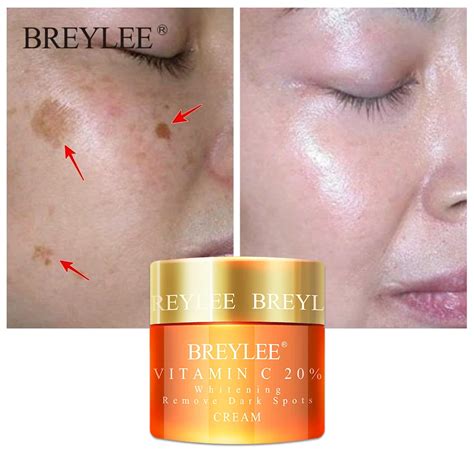 Breylee Vitamin C 20% Vc Whitening Facial Cream Repair Fade Freckles ...